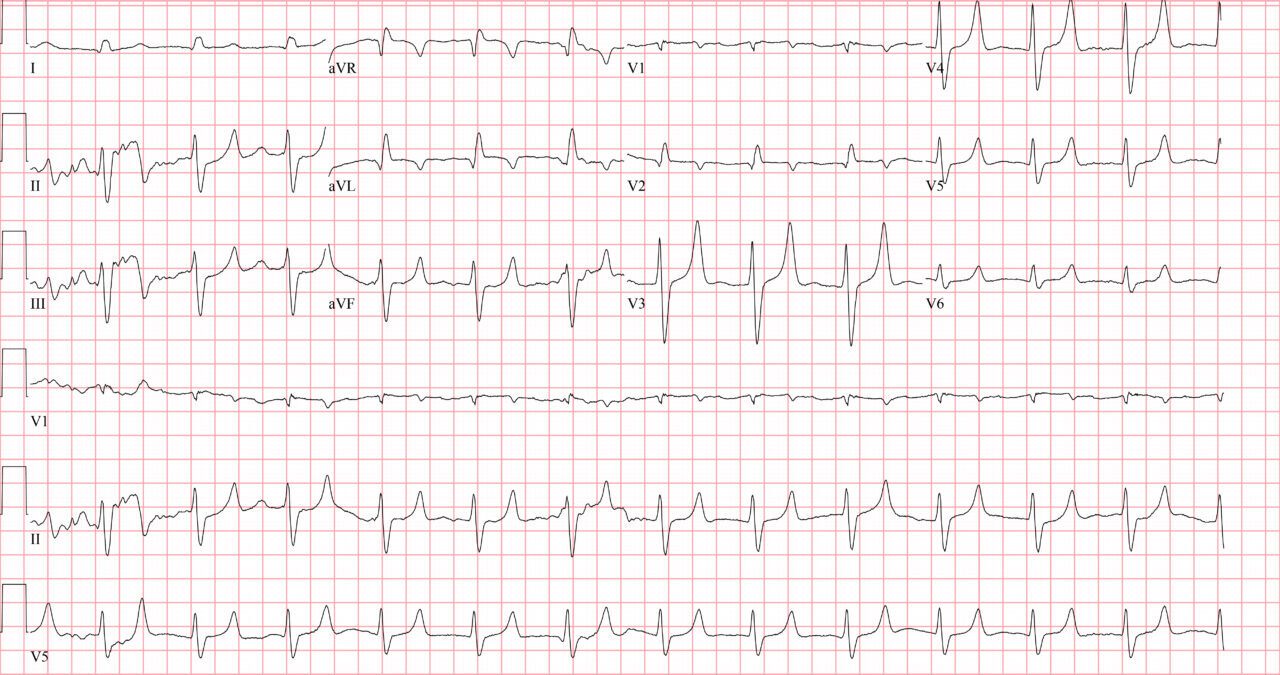 Validation Assessment | ECG Stampede